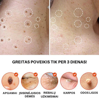 Mikro adatėlių pleistrai nuo odos netobulumų