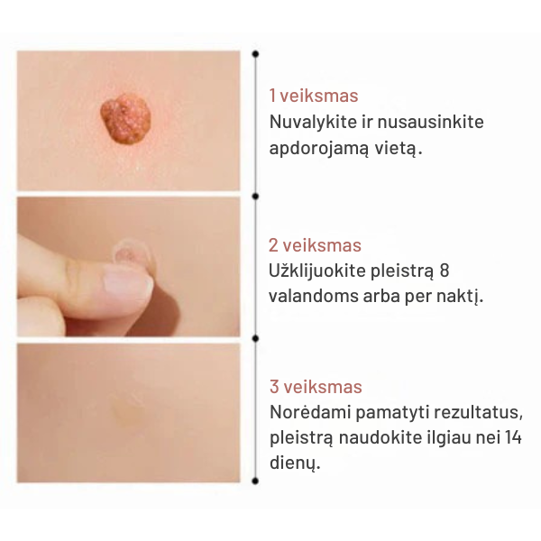 Mikro adatėlių pleistrai nuo odos netobulumų