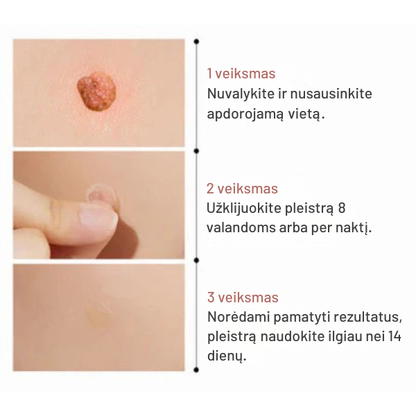 Mikro adatėlių pleistrai nuo odos netobulumų