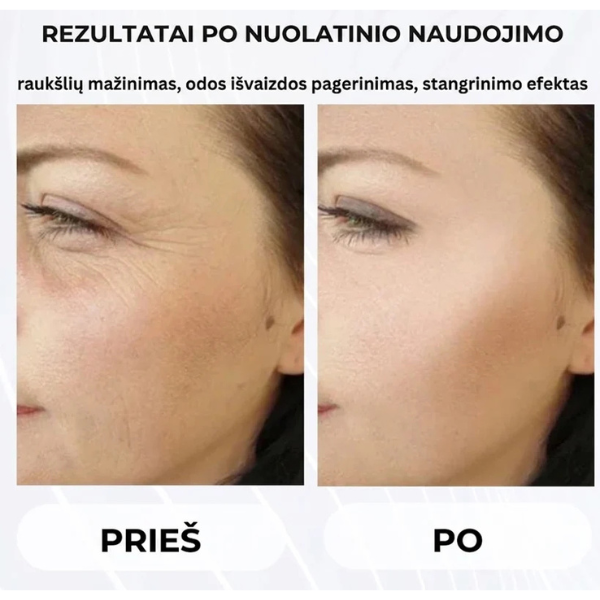 Veido bei kaklo masažuoklis odos stangrinimui ir pakėlimui