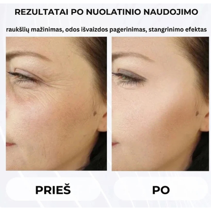 Veido bei kaklo masažuoklis odos stangrinimui ir pakėlimui