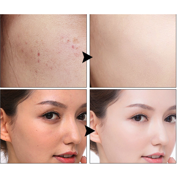 Oro lengvumo SPF 20 CC kremas su kempinėle