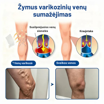 Mikroadatinis pleistras venų skausmui malšinti