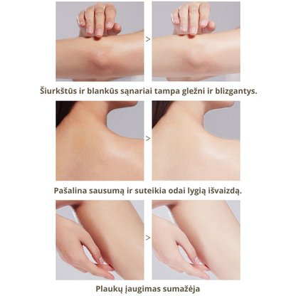 Apelsinų fermentų šveičiamasis gelis – švelnus negyvos odos šalinimas