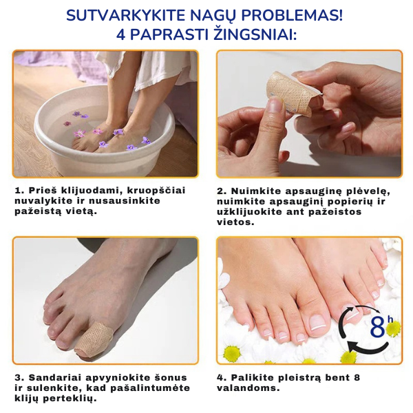 Gydomieji pleistrai nagams