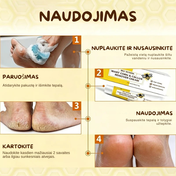Bičių nuodų kremas nuospaudoms ir suragėjusiai odai