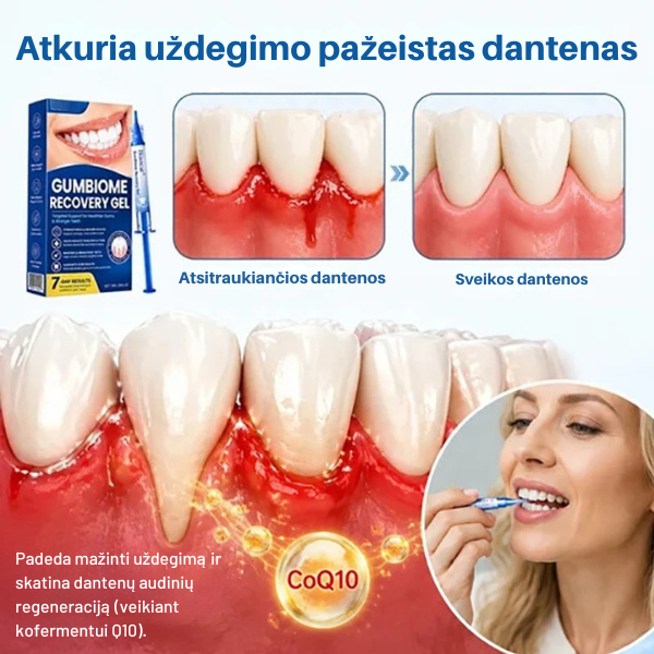 Gelis dantenų priežiūrai su hialurono rūgštimi