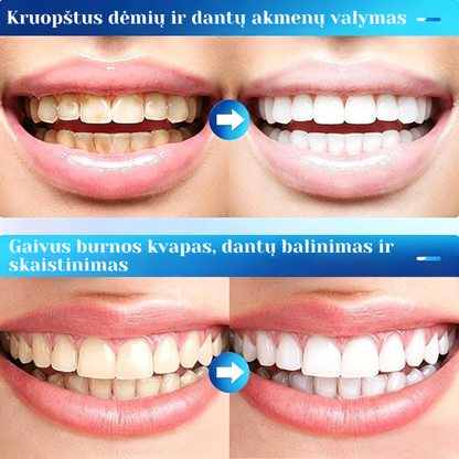 Gelis dantenų priežiūrai su hialurono rūgštimi