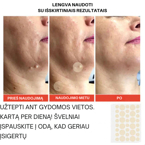 Mikro adatėlių pleistrai nuo odos netobulumų